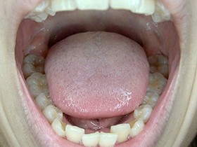 300人のおくち 第1集　サンプル画像10